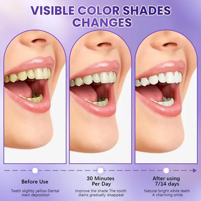 Purple Teeth Whitening Strips