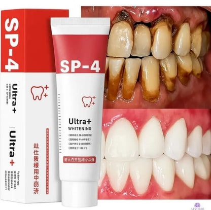 SP-4 Probiotic Whitening Toothpaste